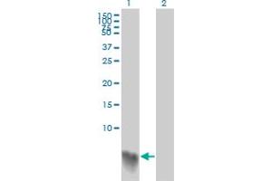 Western Blot analysis of S100A2 expression in transfected 293T cell line by S100A2 monoclonal antibody (M03A), clone 3H8. (S100A2 Antikörper  (AA 1-97))