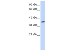 Septin 12 antibody used at 1 ug/ml to detect target protein. (Septin 12 Antikörper  (Middle Region))
