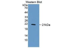 Detection of Recombinant PDGFBB, Human using Polyclonal Antibody to Platelet Derived Growth Factor BB (PDGF BB) (PDGF-BB Homodimer (AA 82-190) Antikörper)