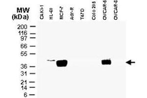 Western blot analysis of CARD8 in tumor cell lines.