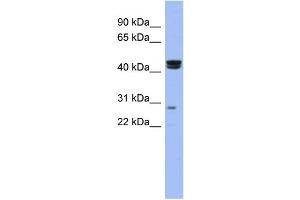 WB Suggested Anti-HSFY1 Antibody Titration:  0. (HSFY1 Antikörper  (N-Term))