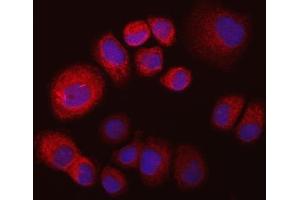 IF analysis of IMPDH2 using anti-IMPDH2 antibody (ABIN7603063).