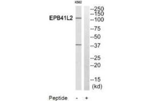 Western blot analysis of extracts from HuvEc cells and HeLa cells, using PPP2R5A antibody. (PPP2R5A Antikörper)