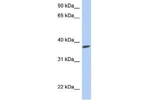 WB Suggested Anti-RTDR1 Antibody Titration: 0. (RTDR1 Antikörper  (Middle Region))