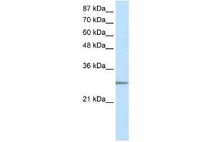 WB Suggested Anti-C20ORF20 Antibody Titration: 2. (MRGBP Antikörper  (N-Term))