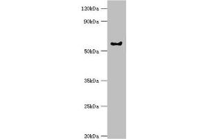 Western blot All lanes: G protein-coupled receptor kinase 6 antibody at 6 μg/mL + Rat heart tissue Secondary Goat polyclonal to rabbit IgG at 1/10000 dilution Predicted band size: 66, 68, 65 kDa Observed band size: 66 kDa (GRK6 Antikörper  (AA 1-170))