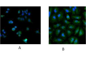 Immunofluorescence staining of MCF7 (A) and HeLa (B) cells with 5ug/ml ABIN184900 antibody.