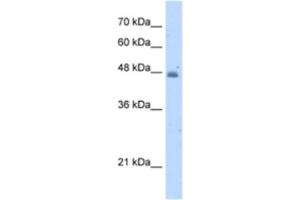 Western Blotting (WB) image for anti-Kynureninase (L-Kynurenine Hydrolase) (KYNU) antibody (ABIN2462922)