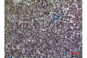 Immunohistochemistry (IHC) analysis of paraffin-embedded Human Liver, antibody was diluted at 1:100. (ALDH1A1 Antikörper  (N-Term))