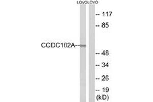 Western blot analysis of extracts from LOVO cells, using CCDC102A Antibody. (CCDC102A Antikörper  (AA 341-390))