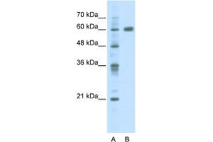 WB Suggested Anti-PDLIM5 Antibody Titration:  2. (PDLIM5 Antikörper  (C-Term))