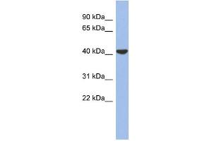 WB Suggested Anti-GJD4 Antibody Titration:  0. (GJD4 Antikörper  (Middle Region))