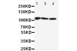 Anti-SERCA1 ATPase antibody, Western blotting Lane 1: Rat Skeletal Muscle Tissue Lysate Lane 2: PANC Cell Lysate Lane 3: U87 Cell Lysate (ATP2A1/SERCA1 Antikörper  (Middle Region))