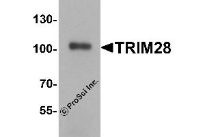 Western Blotting (WB) image for anti-Tripartite Motif Containing 28 (TRIM28) (C-Term) antibody (ABIN1077358) (KAP1 Antikörper  (C-Term))