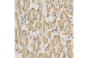 Immunohistochemistry of paraffin-embedded human stomach using PRDX4 antibody at dilution of 1:200 (x400 lens) (Peroxiredoxin 4 Antikörper  (AA 38-271))