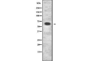 Western blot analysis of Collagen IX α2 using COS7 whole cell lysates (Collagen Type IX alpha 2 (COL9A2) Antikörper)