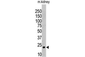 The ISG15 polyclonal antibody  is used in Western blot to detect ISG15 in mouse kidney tissue lysate. (ISG15 Antikörper  (N-Term))