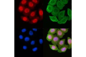 ABIN6256976 and ABIN6274481 staining Hela cells(45 min of heat-shock) by IF/ICC. (Cyclin-Dependent Kinase 15 (ALS2CR7) (Internal Region) Antikörper)