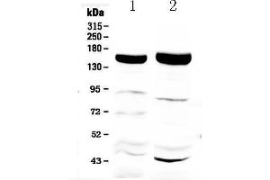 Western blot analysis of Xanthine Oxidase using anti-Xanthine Oxidase antibody . (XDH Antikörper  (AA 2-343))