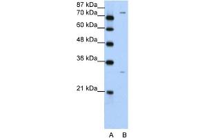 WB Suggested Anti-PTGS1 Antibody Titration:  5. (PTGS1 Antikörper  (N-Term))