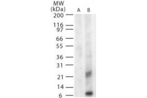 Image no. 2 for anti-West Nile Virus Matrix (WNV M) (AA 8-27) antibody (ABIN199989) (WNV M Antikörper  (AA 8-27))