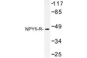 Image no. 1 for anti-Neuropeptide Y Receptor Y5 (NPY5R) antibody (ABIN317759) (NPY5R Antikörper)
