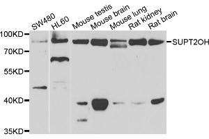 Western blot analysis of extracts of various cell lines, using SUPT20H antibody (ABIN5975125) at 1/1000 dilution. (FAM48A/P38IP Antikörper)