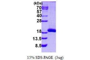 Spermidine/Spermine N1-Acetyltransferase 2 (SAT2) protein (His tag)