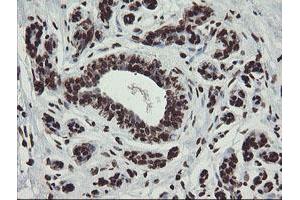 Immunohistochemical staining of paraffin-embedded Human breast tissue using anti-CHN1 mouse monoclonal antibody. (CHN1 Antikörper)