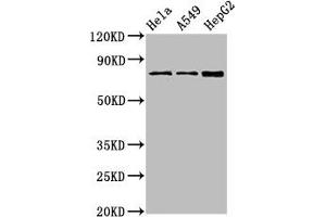 Western Blot Positive WB detected in: Hela whole cell lysate, A549 whole cell lysate, HepG2 whole cell lysate All lanes: TGM2 antibody at 4 μg/mL Secondary Goat polyclonal to rabbit IgG at 1/50000 dilution Predicted band size: 78, 62, 39 kDa Observed band size: 78 kDa (Transglutaminase 2 Antikörper  (AA 4-544))