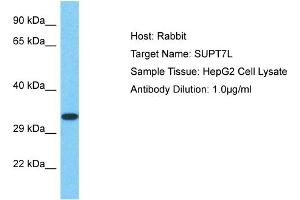 Host: Rabbit Target Name: SUPT7L Sample Type: HepG2 Whole Cell lysates Antibody Dilution: 1.