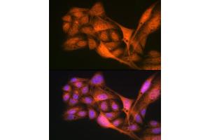 Immunofluorescence analysis of U-2 OS cells using Gli3 Rabbit mAb (ABIN7267385) at dilution of 1:100 (40x lens). (GLI3 Antikörper)
