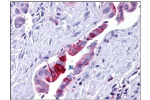 Human Pancreas, Duct: Formalin-Fixed, Paraffin-Embedded (FFPE) (Retinoblastoma Binding Protein 8 Antikörper)