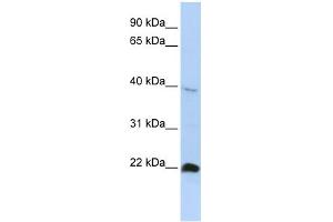 WB Suggested Anti-NKX3-2 Antibody Titration: 0. (NKX3-2 Antikörper  (Middle Region))