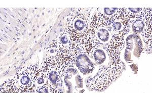 Detection of IL6 in Rabbit Colon Tissue using Monoclonal Antibody to Interleukin 6 (IL6) (IL-6 Antikörper  (AA 27-241))