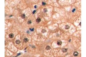 Detection of VEGF165 in Human Liver Tissue using Monoclonal Antibody to Vascular Endothelial Growth Factor 165 (VEGF165) (VEGF 165 (AA 28-191) Antikörper)