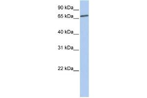 WB Suggested Anti-LSS Antibody Titration:  0. (LSS Antikörper  (N-Term))