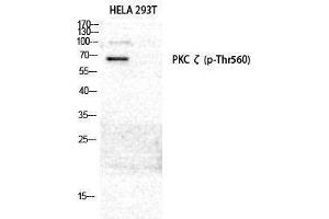 Western Blotting (WB) image for anti-Protein Kinase C, zeta (PRKCZ) (pThr560) antibody (ABIN3172963) (PKC zeta Antikörper  (pThr560))
