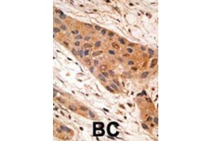 Immunohistochemistry (IHC) image for anti-BCL2/adenovirus E1B 19kDa Interacting Protein 1 (BNIP1) (BH3 Domain) antibody (ABIN2997180) (BNIP1 Antikörper  (BH3 Domain))