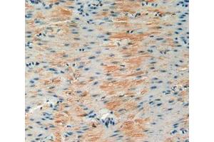 Used in DAB staining on fromalin fixed paraffin- embedded stomach tissue (IGFBP6 Antikörper  (AA 46-238))