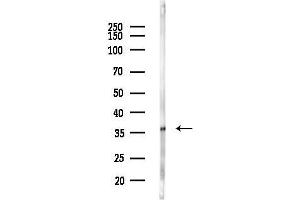 anti-RWD Domain Containing 2B (RWDD2B) antibody