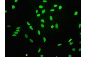 Immunofluorescence staining of Hela cells(treated by 15 mM sodium butyrate for 30 min) with ABIN7127269 at 1:68,counter-stained with DAPI. (Rekombinanter HIST1H3A Antikörper  (H3K4ac))