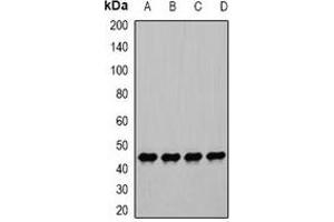 Western blot analysis of PGK1 expression in Hela (A), PC3 (B), ES2 (C), mouse stomach (D) whole cell lysates.