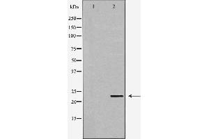 Western blot analysis of Hela whole cell lysates, using GSTP1 Antibody. (GSTP1 Antikörper  (N-Term))