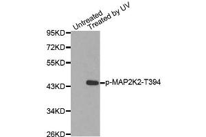 Western blot analysis of extracts from HepG2 cells using Phospho-MAP2K2-T394 antibody (ABIN2987359). (MEK2 Antikörper  (pThr394))