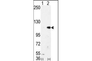 Western blot analysis of AOF2 (arrow) using LSD1 Antibody (N-term) (ABIN388021 and ABIN2845463). (LSD1 Antikörper  (N-Term))