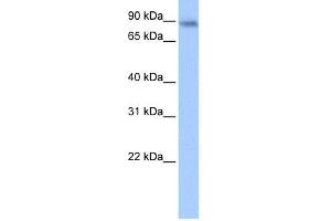 WB Suggested Anti-JAKMIP1 Antibody Titration:  0. (JAKMIP1 Antikörper  (Middle Region))