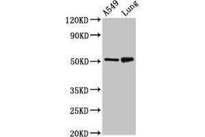 Western Blot Positive WB detected in: A549 whole cell lysate, Rat lung tissue All lanes: IRX3 antibody at 5 μg/mL Secondary Goat polyclonal to rabbit IgG at 1/50000 dilution Predicted band size: 53 kDa Observed band size: 53 kDa (IRX3 Antikörper  (AA 285-378))