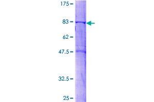 Sorting Nexin 4 Protein (SNX4) (AA 1-450) (GST tag)