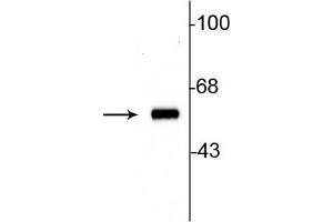 Western blot of 10ug of rat striatal lysate showing specific immunolabeling of the ~60 kDa tyrosine hydroxylase protein. (Tyrosine Hydroxylase Antikörper)